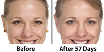 results of skin care cream